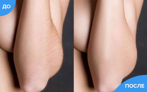 Жидкий лазер (Liquid laser) в Уфе