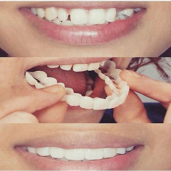 Snap on Smile (Снап он Смайл) в Екатеринбурге