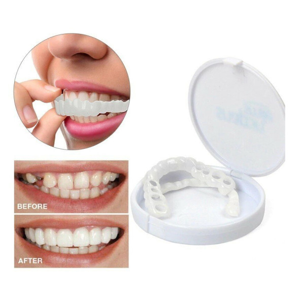 Snap on Smile (Снап он Смайл) в Екатеринбурге