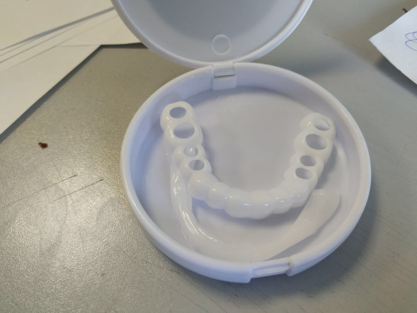 TruSmile Veneers (Виниры Тру Смайл) в Омске