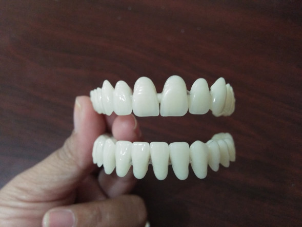 TruSmile Veneers (Виниры Тру Смайл) в Омске